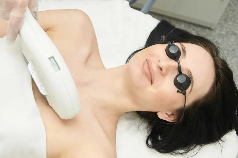 Depilacja laserowa twarzy: Ile zabiegów naprawdę potrzebujesz?