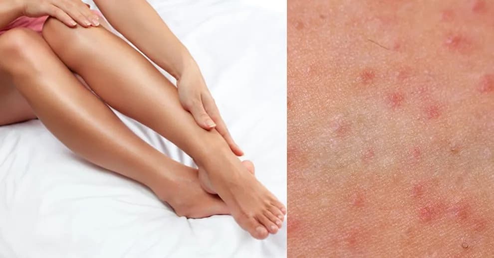 Krostki po goleniu? Pozbądź się ich! Gładka skóra bez podrażnień