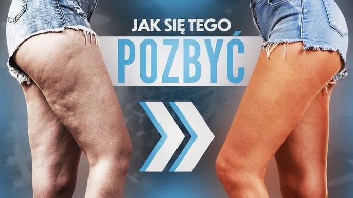 Jak pozbyłam się cellulitu? Mój kompleksowy plan krok po kroku